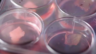 Biyoteknoloji ile Açlık Sorunu Çözülebilir mi? 25 biyoteknoloji