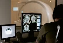 Tomografi Nedir? 3 Tomografi Nedir